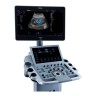 УЗИ аппарат Edan Acclarix LX25