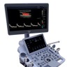 УЗИ аппарат Edan Acclarix LX9
